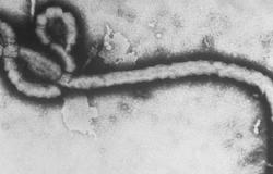 فشل محاولات علاج المصابين بالإيبولا ببلازما دم الناجين من المرض