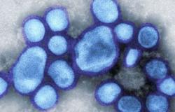 وفاة 11 شخصا جراء إصابتهم بأنفلونزا الخنازير فى سوريا