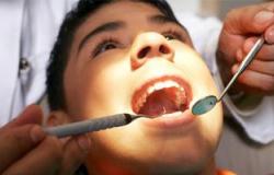 تعرف على أضرار الحشوة الفضية للأسنان والضروس.. تحتوى على عناصر ضارة
