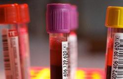 4 اختبارات للدم يجب إجراؤها بعد سن الخمسين