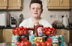 شاب إنجليزى يدمن الطماطم لإصابته باضطراب الطعام.. والسبب البازلاء