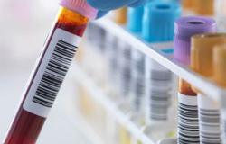 باحثون أستراليون يتوصلون لتحليل دم جديد لسرعة تشخيص السرطان